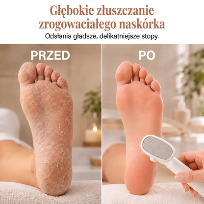 🌈🌈LEFUN® Precyzyjny pilnik do stóp – 🌟usuwa szorstką i zrogowaciałą skórę, pomaga wygładzić pięty i pozwala wygodnie zadbać o stopy w domu.